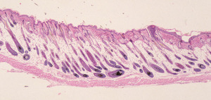 Adrenocortical_Dysplasia_(acd)_Chr8