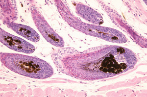 Adrenocortical_Dysplasia_(acd)_Chr8