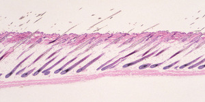 Adrenocortical_Dysplasia_(acd)_Chr8