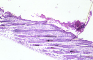 Asebia_(Stearoyl-Coenzyme_A_Desaturase_1)