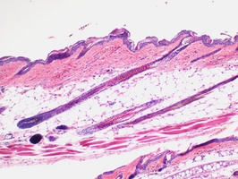 Asebia_(Stearoyl-Coenzyme_A_Desaturase_1)