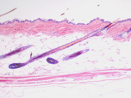 Asebia_(Stearoyl-Coenzyme_A_Desaturase_1)