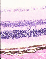 Beige_Lysosomal_trafficing_regulator_(Lyst-bg)_Chr13