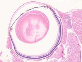 Beige_Lysosomal_trafficing_regulator_(Lyst-bg)_Chr13