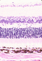 Beige_Lysosomal_trafficing_regulator_(Lyst-bg)_Chr13