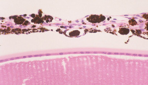 Beige_Lysosomal_trafficing_regulator_(Lyst-bg)_Chr13