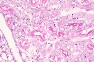 Beige_Lysosomal_trafficing_regulator_(Lyst-bg)_Chr13