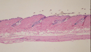 Caracul(Krt2-6g-ca)_Chr15