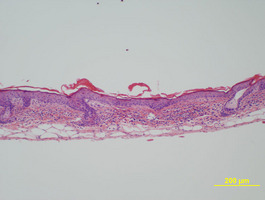 Chronic_Proliferative_Dermatitis_Mutation_(cpdm)_Chr15