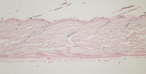 Chronic_Proliferative_Dermatitis_Mutation_(cpdm)_Chr15