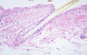 Chronic_Proliferative_Dermatitis_Mutation_(cpdm)_Chr15