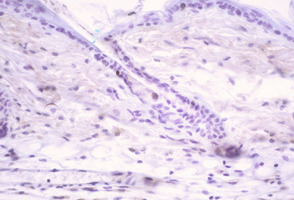 Chronic_Proliferative_Dermatitis_Mutation_(cpdm)_Chr15