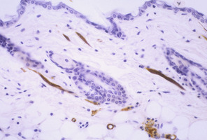 Chronic_Proliferative_Dermatitis_Mutation_(cpdm)_Chr15