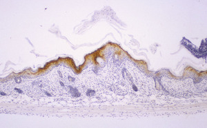 Chronic_Proliferative_Dermatitis_Mutation_(cpdm)_Chr15