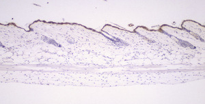 Chronic_Proliferative_Dermatitis_Mutation_(cpdm)_Chr15