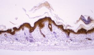 Chronic_Proliferative_Dermatitis_Mutation_(cpdm)_Chr15