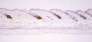 Chronic_Proliferative_Dermatitis_Mutation_(cpdm)_Chr15