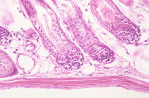 Epidermal_Growth_Factor_Receptor_(Egfr)_Chr11