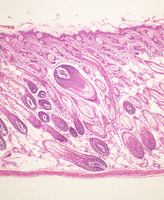 Epidermal_Growth_Factor_Receptor_(Egfr)_Chr11