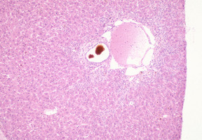 Ferrochelatase_Deficiency(Fech)_Chr18