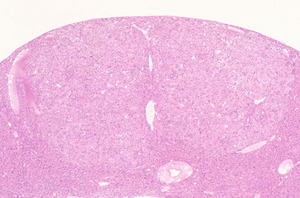 Ferrochelatase_Deficiency(Fech)_Chr18